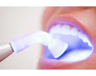 Blanqueamiento_D_58bf4527342ed