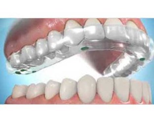 Ferula_Oclusal___58bf2d797468f